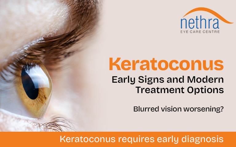 best eye hospital in kerela